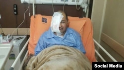 علیرضا رجایی، روزنامه‌نگار و از فعالان ملی – مذهبی، پس از عمل جراحی، چشم راست و بخشی از ماهیچه و استخوان‌های سمت راست صورتش را از دست داده است.