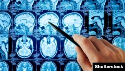 Иллюстрациялык сүрөт. 