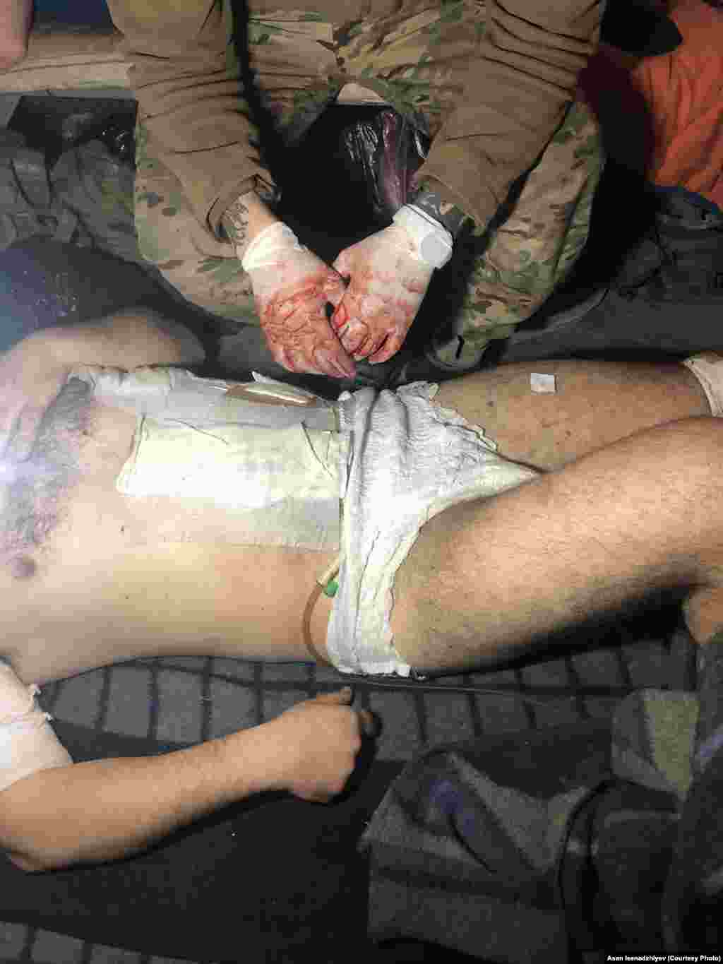 Bu arbiy "Azovstal" territoriyasında vefat etti. O, Rusiye ordusınıñ ateşine oğrap, ağır yaralandı. Ekimlerniñ bütün ğayretlerine baqmadan, onı qurtarıp olamadılar. Asannıñ aytqanına köre, arbiyler ilâc ve antiseptiklerniñ yetmemezliginden vefat ete ediler