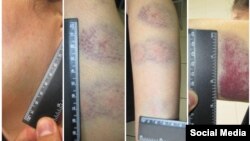 Болот Темиров Фейсбуктагы баракчасына жарыялаган сүрөттөр.