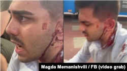 ნაცემი აქტივისტი ნიკო მანაგაძე