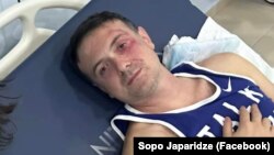 ირაკლი ეძგვერაძე, თბილისის საკრებულოს ფრაქცია „ერთიანი ნაციონალური მოძრაობის" წევრი. 