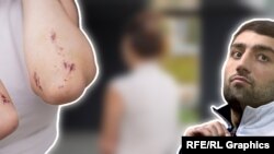 გიორგი ყუშიტაშვილი და ქალი, რომელიც მას ძალადობაში ადანაშაულებს