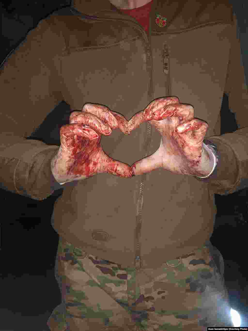 Bu fotoresimde Azovstalde Asan İsenacıyevniñ qanlı elleri körüne. Asan, fotoresimni Instagramda derc etip, şunı yazğan edi: "Anama şunı aytıñız ki, men çoq acılar kördim, amma iç bir vaqıt yıqılmam". 83 kün mudafaa ve 227 kün esirlikte bulunıp, qırımlı arbiy hızmetini bitirdi. Şimdi esas Ukrayinada birinci tibbiy yardım kösterüv kurslarını keçire. Qırımğa qaytmaqnı arzu ete