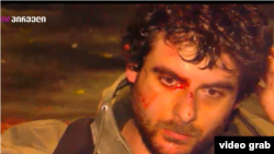 გმირთა მოედანზე დაშავებული. კადრი "ტვ პირველის" ეთერიდან