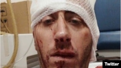 Novinar Vladimir Kovačević nakon napada