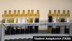 Пробирки с кровью для анализа на ВИЧ, гепатит и сифилис