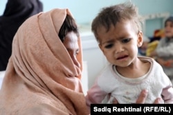 یکی از کودکان مبتلا به سوء تغذیه