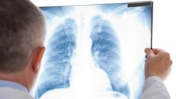 COVID-19: Marynyň keselhanalaryna heniz ýokary okuwy doly tamamlamadyk ýaşlar işe alynýar