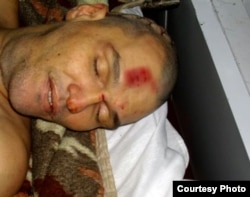Труп заключенного Шамиля Ярославлева. 5 ноября 2011 года.