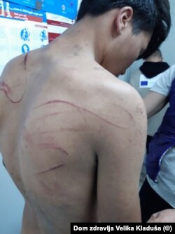 A photograph provided to RFE/RL showing a badly beaten migrant at an outpatient clinic for the Miral camp in Bosnia-Herzegovina (Photo: Dr. Mustafa Hodzic)