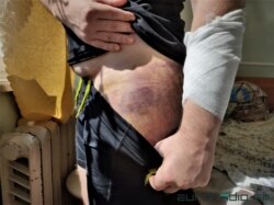 Аляксандар Альхоўскі, пабоі. Фота Эўрарадыё