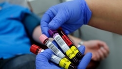 Примероци од крв донирани од оздравени пациенти со коронавирус