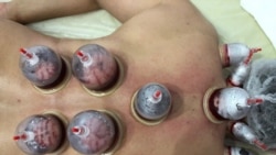 Хижама - коронавирустан айыгуу жолу эмес