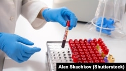 Бишкектеги лабораториялардын бири, 2018-жыл. 