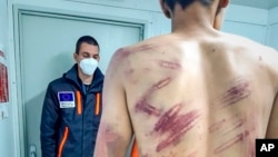 A man poses for photographs taken by medical staff at an outpatient clinic for the Miral camp in Bosnia-Herzegovina. He is one of several migrants there who say they were brutalized and summarily forced back to Bosnia by Croatian law-enforcement when they tried to cross into the EU. 