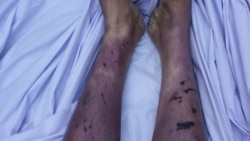 "لُور يې درې کاله وروسته په کفن کې راته راوړه"