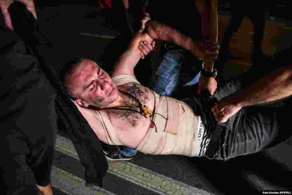 A protester injured during the clashes.&nbsp;