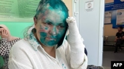 Елена Милашина после нападения