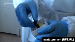 Կորոնավիրուսի թեստ՝ արտադրված Հայաստանում, մայիս, 2020թ.