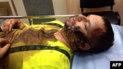 Opposition activist Dmytro Bulatov receives medical attention in Kyiv on January 31.