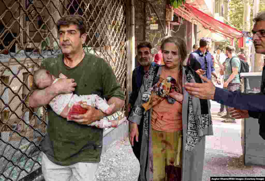 3. 15 ივნისი: კაცი დაშავებული ჩვილით ხელში, თეირანში მომხდარი აფეთქების შემდეგ.