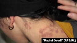 Tajikistan,Dushanbe city, Shahnoza Safarova a resident of Dushanbe city detained by police and torture by police officials,24December2012