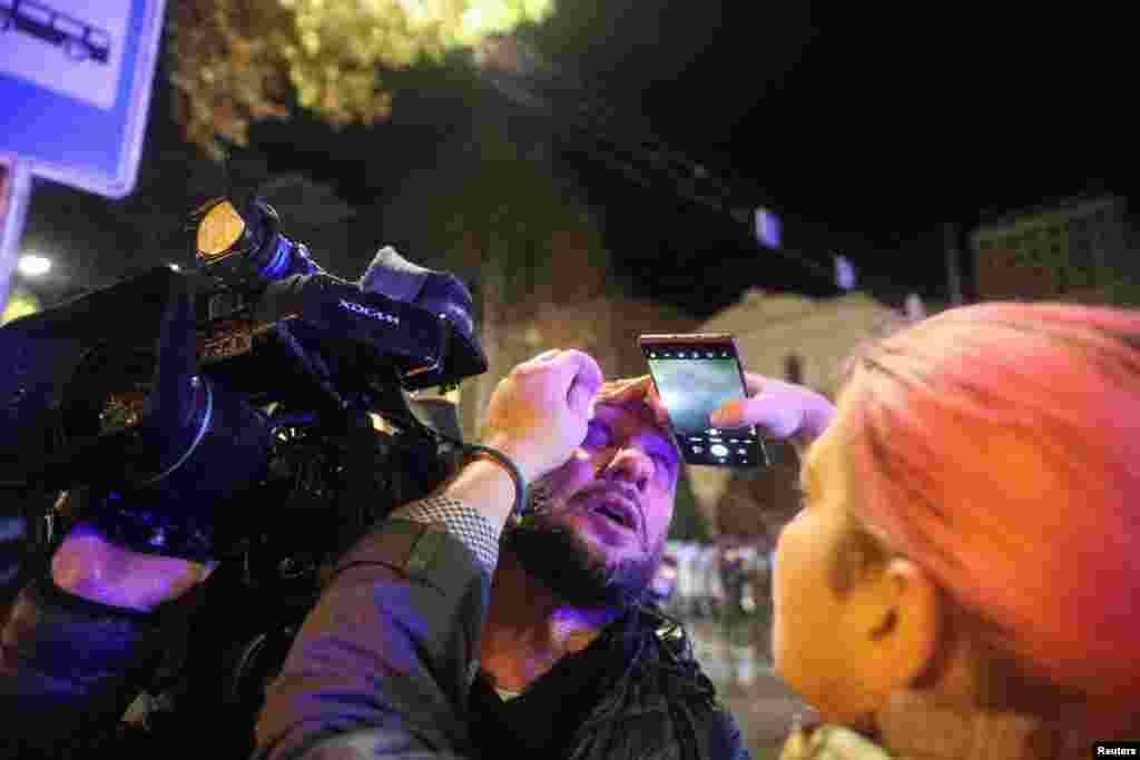 За інформацією грузинської служби Радіо Свобода, серед постраждалих є кілька журналістів.&nbsp;Грузинська служба Радіо Свобода повідомляє, що особливо жорстко силовики діяли щодо журналістів, які виконували свої професійні обов'язки