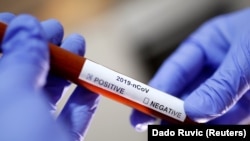 لوله آزمایش ویروس کوید-۱۹