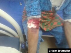 Один из отравившихся Зоокумарином узбекистанцев.