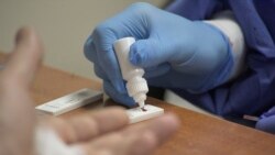 УКРАИНА - Медицински работник спроведува тест за коронавирус КОВИД-19