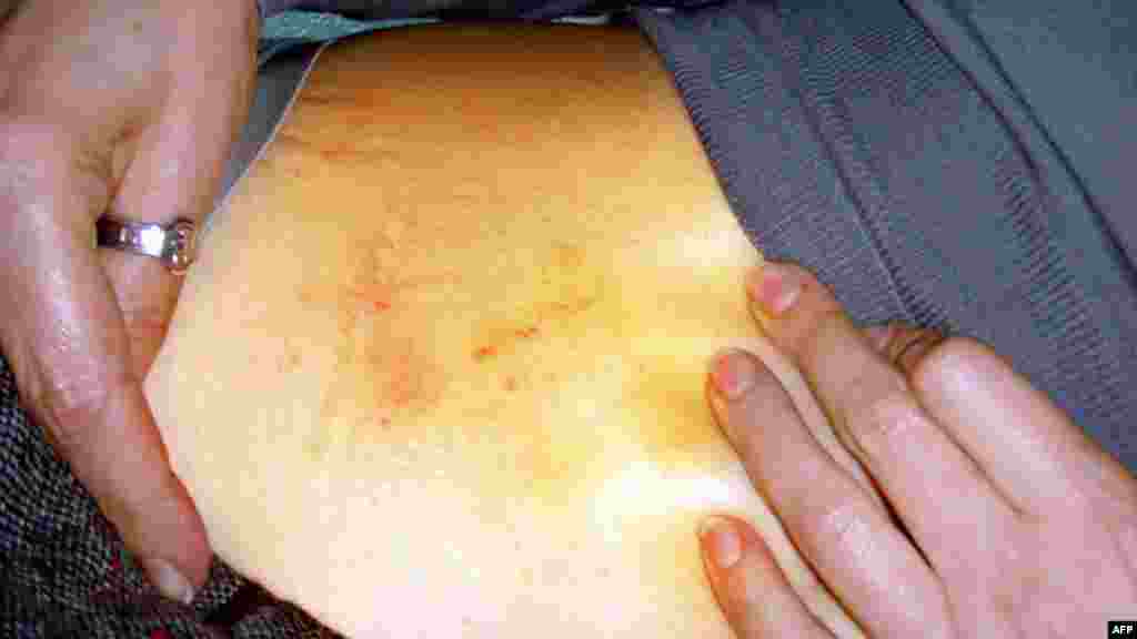 24 апреля стало известно, что с 20 апреля Юлия Тимошенко начала голодовку &ndash; после того, как ее избили в Качановской колонии и принудительно доставили на лечение в харьковскую больницу "Укрзализныци"