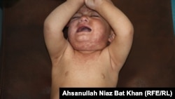 په پکتيا ولايت په شري يو ناروغ ماشوم