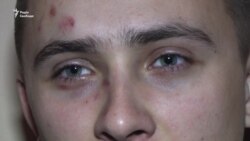 Били чимось схожим на биту – Стерненко про обставини свого побиття (відео)