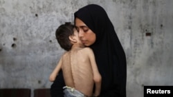 Samah Matar, o mamă palestiniană strămutată, își ține în brațe fiul subnutrit, Youssef, care suferă de paralizie cerebrală, într-o școală unde se adăpostesc în timpul crizei alimentare, în orașul Gaza, 24 iulie 2025.