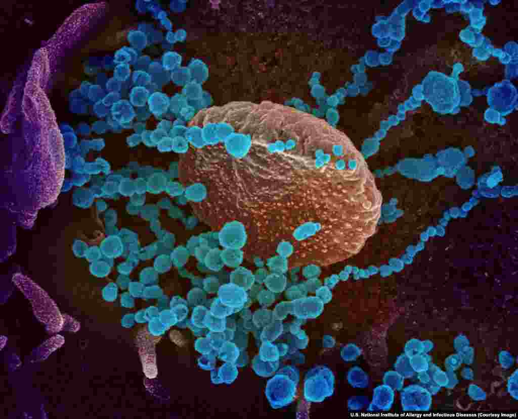 Вируси САРС-КоВ-2 кои во човечка клетка. Сите фотографии во оваа галерија се обоени со употреба на софтвер. &nbsp;