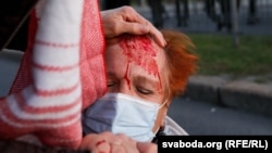 A protester was badly injured after being hit by riot police during a crackdown against an anti-government rally in Minsk on September 23 protesting Belarusian strongman Alyaksandr Lukashenka's alleged landslide reelection.