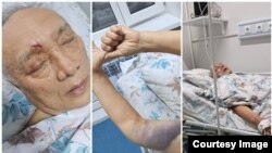 Султанбай Айжигитов ооруканадан салган сүрөттөр.